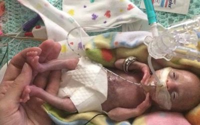 A new framework for managing extremely preterm births