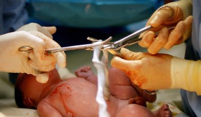 Intact cord resuscitation versus early cord clamping in the treatment of depressed newborn infants during the first 10 minutes of birth (Nepcord III)